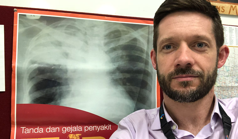Infectious diseases physician Justin Denholm is keen to spread education about latent TB infection in Australia as widely as possible.