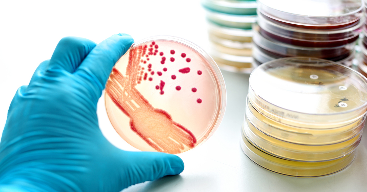 RACGP - CBD shown to kill antibiotic resistant bacteria