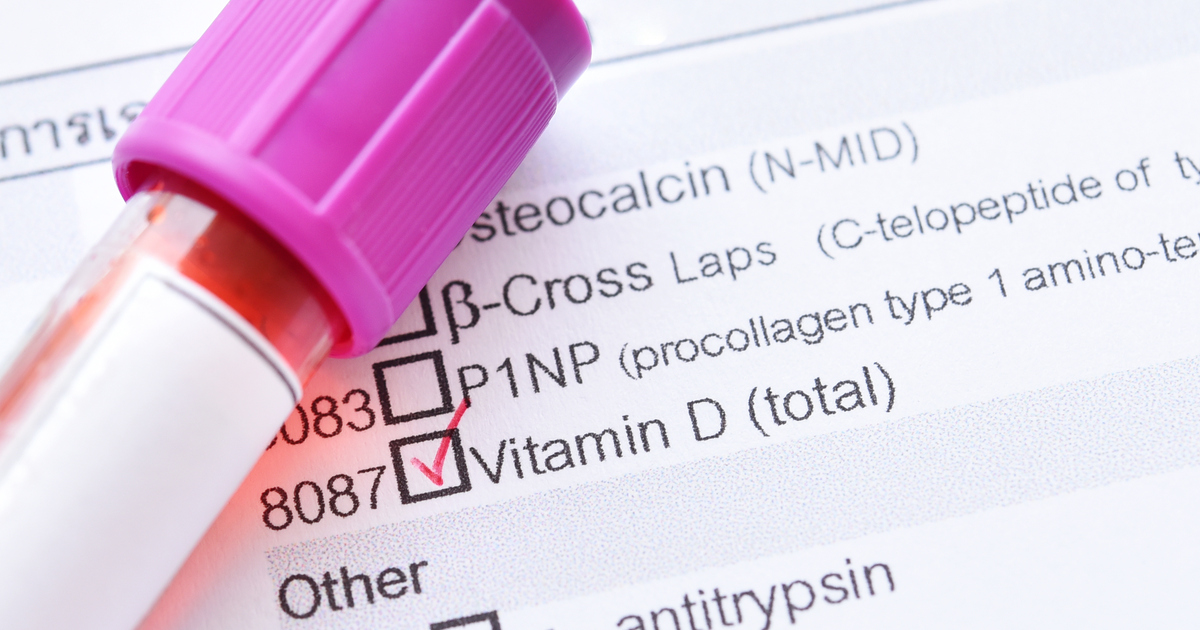 RACGP Vitamin D deficiency To test or not to test