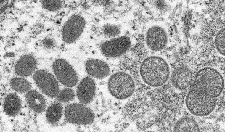Microscopic image of a monkeypox virion.