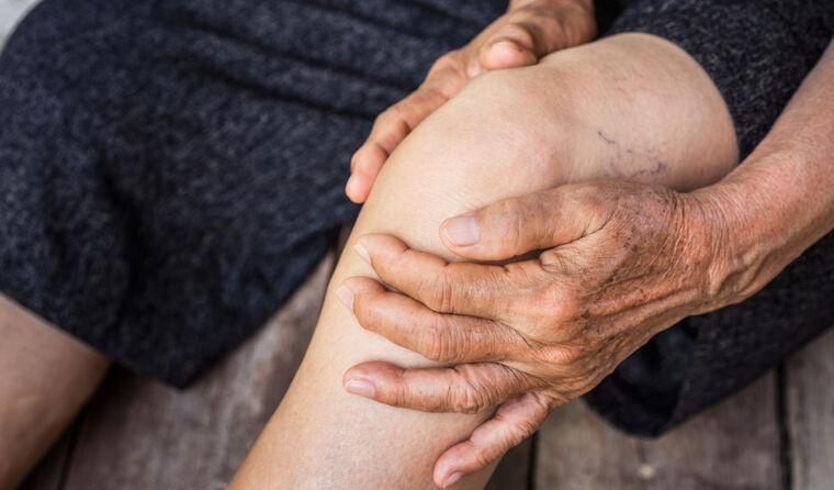 Knee suffering osteoarthritis