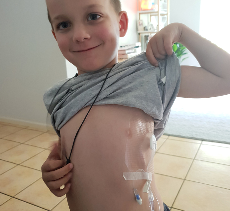 Mason was diagnosed with a severe form of haemophilia when he was three months old.