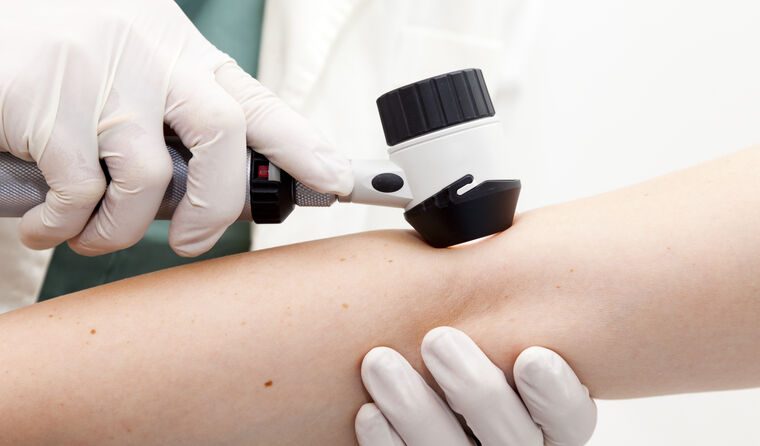 A patient having skin check.