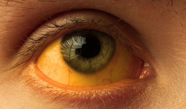 Close up of a person's eye.