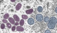 Colourised electron microscopic image of a monkeypox virion. (Image: US CDC)