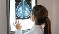 The research showed a rise in diagnosis of advanced breast cancers.