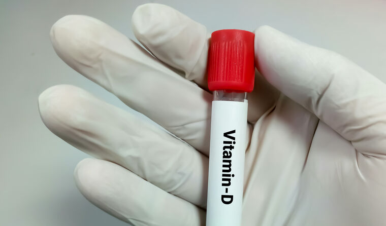 Vitamin D test tube sample.
