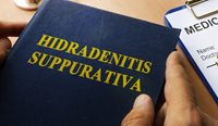 Hidradenitis suppurativa is a chronic autoinflammatory disease characterised by the development of abscesses, nodules, comedones and tunnels.