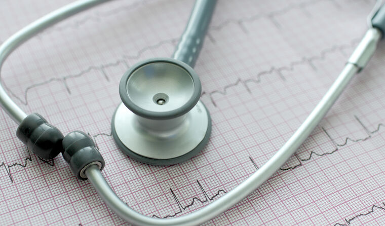 newsGP - Preventive care for atrial fibrillation currently 'less than ideal' - RACGP