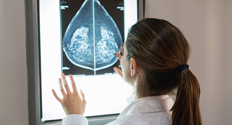 Doctor examining mammogram scan.