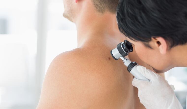 Doctor inspecting mole