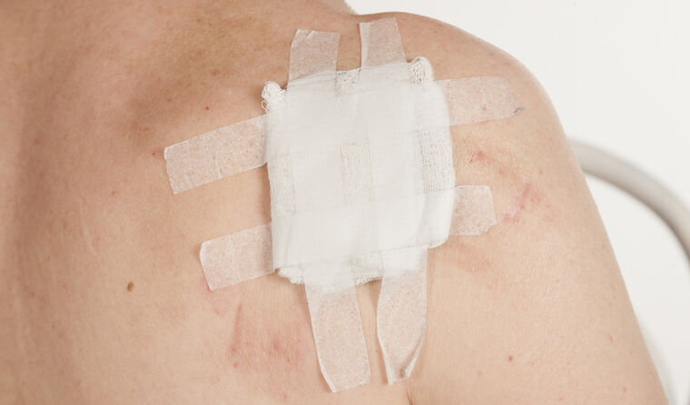 A woman's shoulder with a dressing on it.