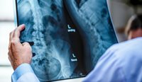 Efforts to reduce the use of X-rays for lower back pain have often failed. Here’s why. 