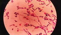 Multidrug-resistant shigella strains are circulating among the Victorian community.
