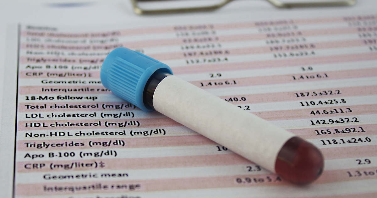 RACGP - Heart attack risk: Is expanded cholesterol testing warranted?