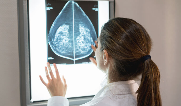 Doctor examining breast x-ray.