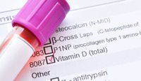 The RACGP does not recommend to routinely measure vitamin D in the general population.