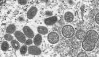 Microscopic image of a monkeypox virion.