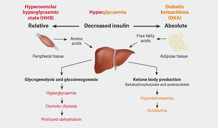 Figure 1. A comparison of the physiological changes in hyperosmolar hyperglycaemic state and diabetic ketoacidosis