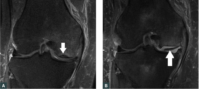 AJGP-06-2020-Clinical-Ridley-Imaging-Knee-Fig-10.jpg