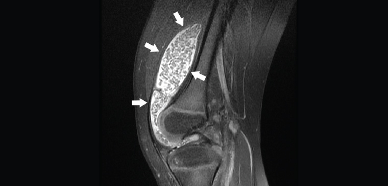 AJGP-06-2020-Clinical-Ridley-Imaging-Knee-Fig-12.jpg