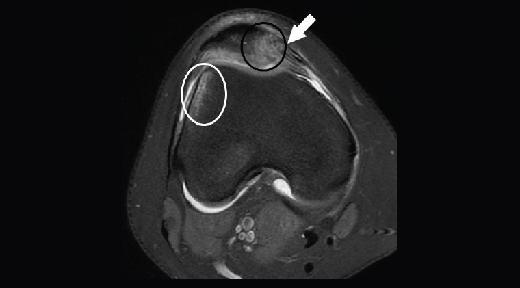 AJGP-06-2020-Clinical-Ridley-Imaging-Knee-Fig-7.jpg