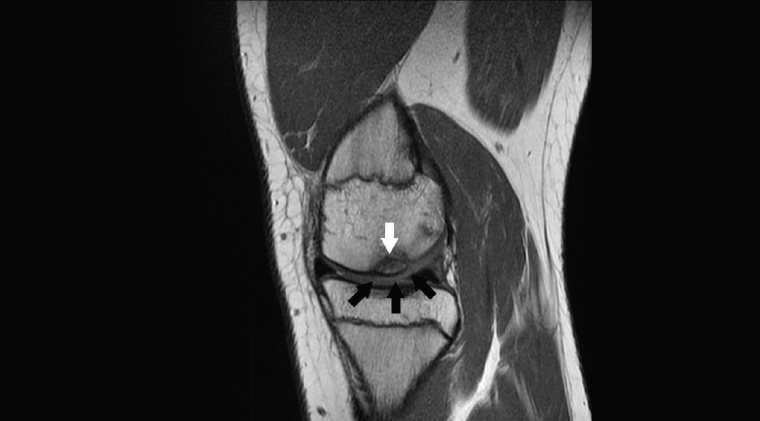AJGP-06-2020-Clinical-Ridley-Imaging-Knee-Fig-8.jpg