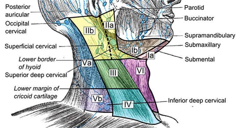 RACGP An Approach To Neck Masses In Adults   AJGP 05 2020 Clinical Tan Approach Neck Masses Adults Fig01 .aspx