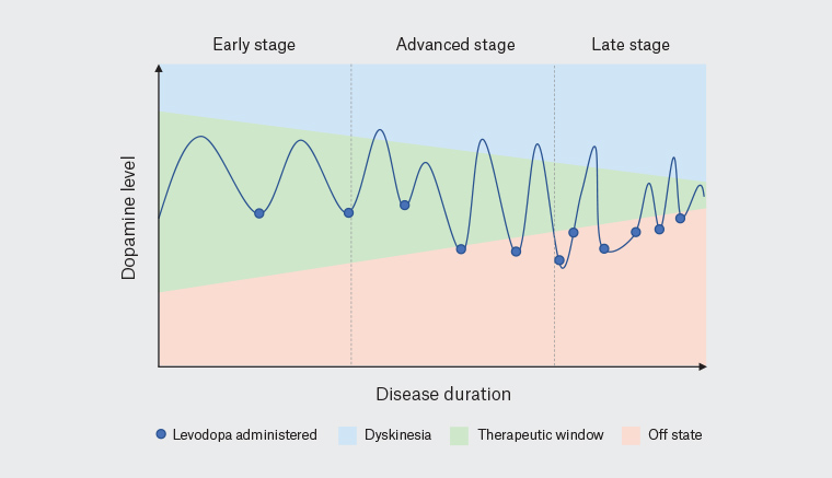 RACGP - Managing Late Stage Parkinsons Disease