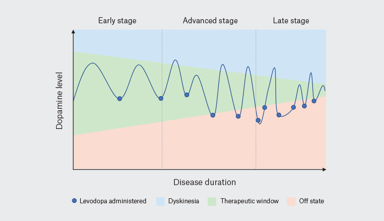 Figure 2. The therapeutic window in Parkinson’s disease narrows with progression through disease stage.