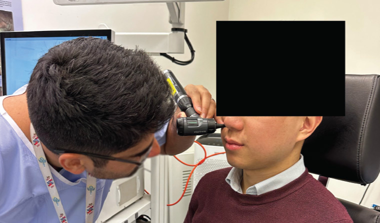 Otoscopic examination of the nasal cavity.
