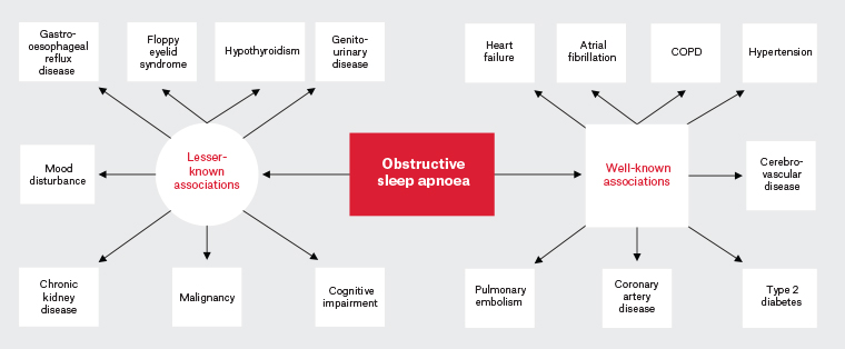 RACGP Urological manifestations of obstructive sleep apnoea