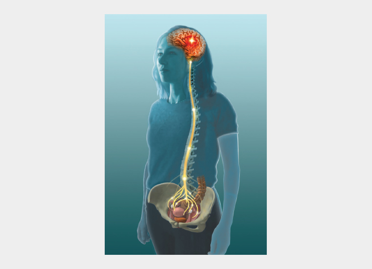 Figure 5. Enhanced activation of the central nervous system present in patients with pelvic pain.