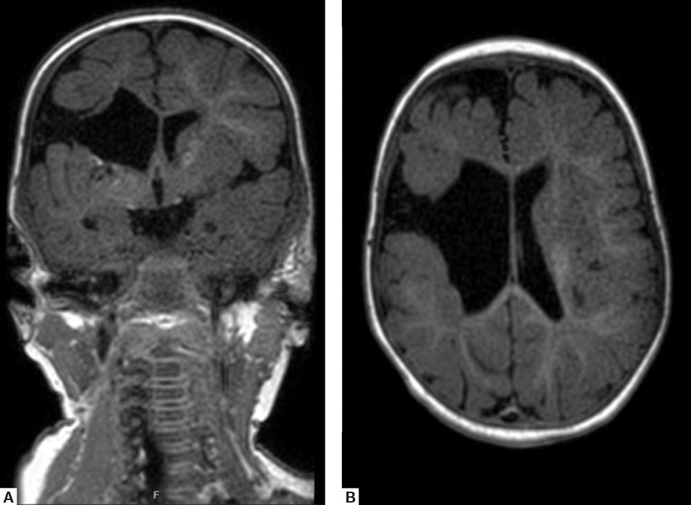 12_7795-Fig-2a2b-combined-RGB.jpg