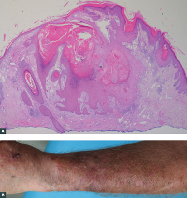 AJGP-0102-26-7648-CS-Frear-Keratin-Figure-2-WEB.jpg AJGP-0102-26-7648-CS-Frear-Keratin-Figure-2-WEB.jpg