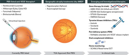 Figure 4. Current and emerging therapies for AMD categorised by regulatory status.