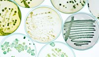 Researchers believe the study is the first to go into global detail for the disease burden of bacterial pathogens.