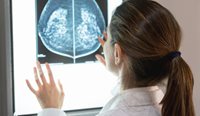 The need for alternative treatment strategies has renewed interest in androgen therapy for breast cancer.