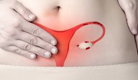 Endometriosis has been found to affect one in 10 Australian women of reproductive age.
