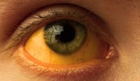In communities identified as being at risk, trachoma prevalence reduced in Aboriginal and Torres Strait Islander children aged 5–9 years to 1.5% in 2024.