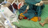 Infant with drug-resistant typhoid