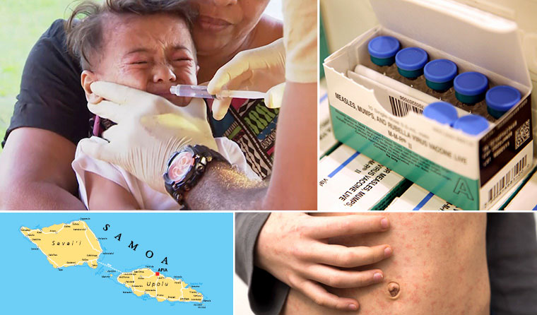 Measles and vaccination in Samoa