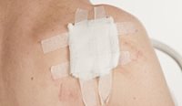 Australia’s new Roadmap for Targeted Skin Cancer Screening Program is due in 2028. 