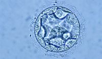 Blastocysts are frozen on day five or six of development and consist of somewhere between 150–200 pluripotent stem cells. (Image: Melbourne IVF)