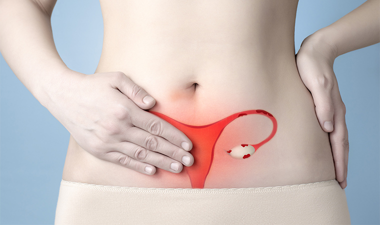 Endometriosis has been found to affect one in 10 Australian women of reproductive age.