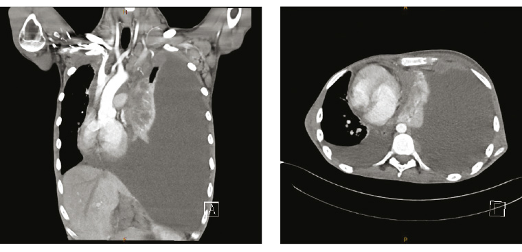 AJGP Clinical O'Bryen Heart on wrong side figure 2