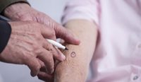 New research recommends the creation of a new classification to differentiate low-risk melanoma cases from other more dangerous melanomas. 