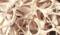 Menopause and osteoporosis: Non-pharmacological and pharmacological management