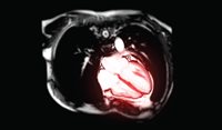 Cardiac imaging: 2022 update